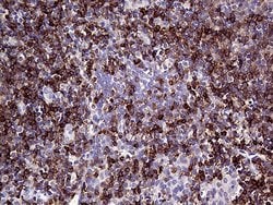 CD79B Monoclonal Antibody (OTI9H8), TrueMAB , OriGene 100 &mu;L; Unconjugated:Antibodies,