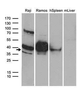 CD79B Monoclonal Antibody (OTI2B6), TrueMAB , OriGene 100 &mu;L; Unconjugated:Antibodies,