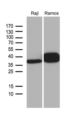 CD79B Mouse anti-Human, Clone: OTI4E11, liquid, TrueMAB 100 &mu;L; Unconjugated:Antibodies,