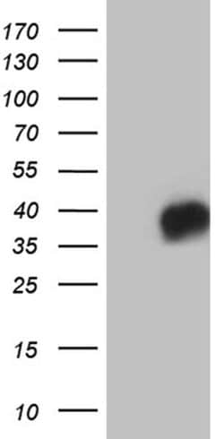 CD79B Monoclonal Antibody (OTI9H8), TrueMAB , OriGene 100 &mu;L; Unconjugated:Antibodies,