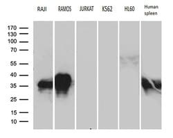 CD79B Monoclonal Antibody (OTI9H8), TrueMAB , OriGene 100 &mu;L; Unconjugated:Antibodies,