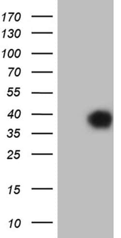 CD79B Monoclonal Antibody (OTI9G1), TrueMAB , OriGene 100 &mu;L | Buy Online | Origene Technologies | Fisher Scientific