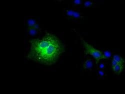 CD80 Monoclonal Antibody (OTI6H7), TrueMAB , OriGene:Antibodies:Primary