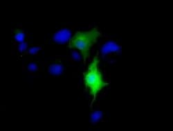 CD80 Monoclonal Antibody (OTI10D8), TrueMAB , OriGene 100 &mu;L; Unconjugated:Antibodies,