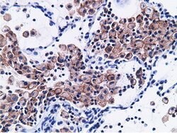CD80 Mouse anti-Human, Clone: OTI2B11, lyophilized, TrueMAB 100 &mu;g;