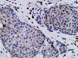 CD80 Mouse anti-Human, Clone: OTI2B11, lyophilized, TrueMAB 100 &mu;g;