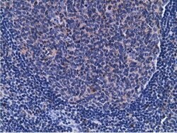 CD80 Mouse anti-Human, Clone: OTI2B11, lyophilized, TrueMAB 100 &mu;g;