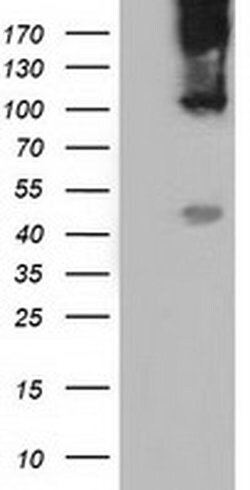 CD80 Monoclonal Antibody (OTI7H7), TrueMAB , OriGene 30 &mu;L; Unconjugated:Antibodies,