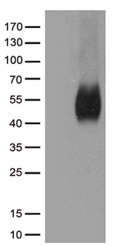 CD80 Monoclonal Antibody (OTI11G5), TrueMAB , OriGene 100 &mu;L; Unconjugated:Antibodies,