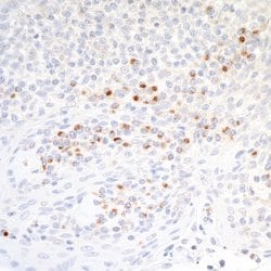 CD86 Recombinant Rabbit Monoclonal Antibody (BLR030F), Bethyl Laboratories 10 &mu;L | Buy Online | Bethyl Laboratories, Inc | Fisher Scientific