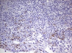 CD8A Mouse anti-Human, Clone: OTI7C10, lyophilized, TrueMAB 100 &mu;g;