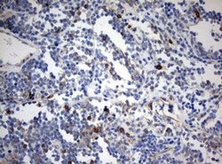 CD99 Monoclonal Antibody (OTI1A4), TrueMAB , OriGene:Antibodies:Primary