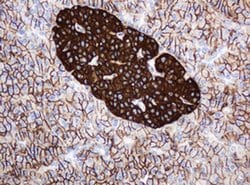 CD99 Monoclonal Antibody (OTI2E8), TrueMAB , OriGene 100 &mu;L; Unconjugated:Antibodies,