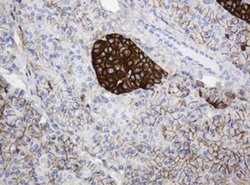 CD99 Monoclonal Antibody (OTI3E8), TrueMAB , OriGene 100 &mu;L; Unconjugated:Antibodies,