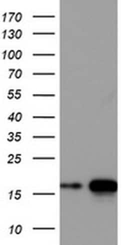 CD99 Monoclonal Antibody (OTI1E7), TrueMAB , OriGene:Antibodies:Primary