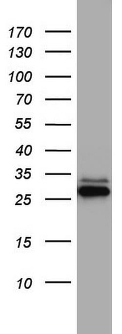CD99 Monoclonal Antibody (OTI1E7), TrueMAB , OriGene:Antibodies:Primary