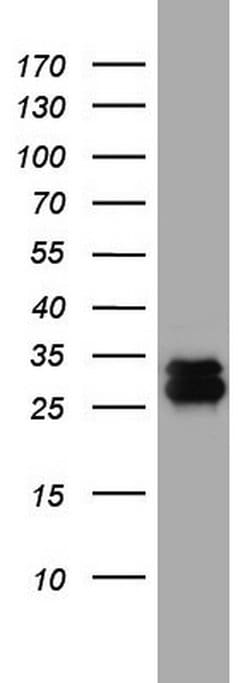 CD99 Monoclonal Antibody (OTI1D5), TrueMAB , OriGene:Antibodies:Primary