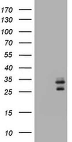 CD99 Monoclonal Antibody (OTI5C8), TrueMAB , OriGene:Antibodies:Primary