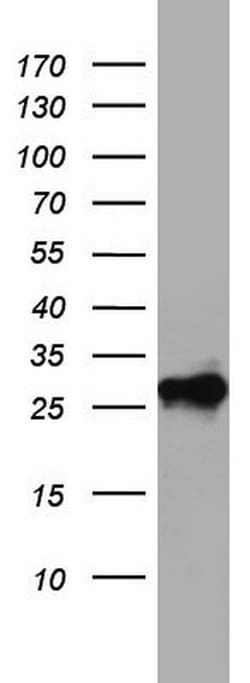 CD99 Monoclonal Antibody (OTI13F10), TrueMAB , OriGene 100 &mu;L; Unconjugated:Antibodies,
