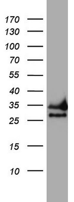 CD99 Mouse anti-Human, Clone: OTI4G5, lyophilized, TrueMAB 100 &mu;g; Unconjugated:Antibodies,