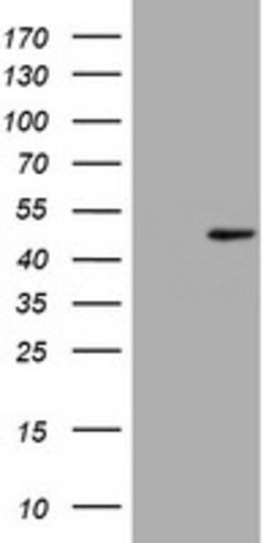 CDC123 Mouse anti-Human, Clone: OTI3G8, lyophilized, TrueMAB 100 &mu;g;