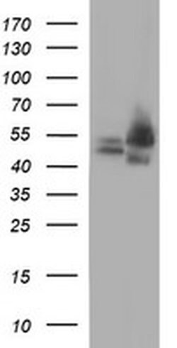 CDC123 Monoclonal Antibody (OTI2D4), TrueMAB , OriGene 100 &mu;L; Unconjugated:Antibodies,