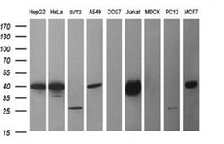 CDC123 Monoclonal Antibody (OTI5C7), TrueMAB , OriGene 100 &mu;L; Unconjugated:Antibodies,