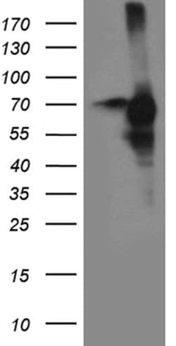 CDC25B Monoclonal Antibody (OTI11C5), TrueMAB , OriGene 100 &mu;L; Unconjugated:Antibodies,