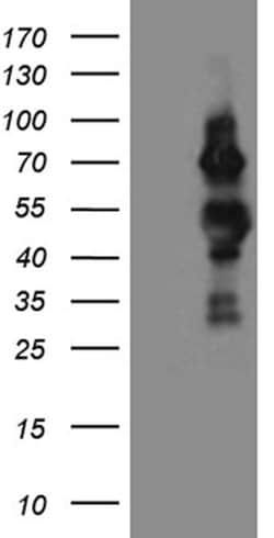 CDC25B Monoclonal Antibody (OTI6H9), TrueMAB , OriGene 30 &mu;L; Unconjugated:Antibodies,