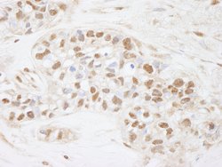 CDC25c Polyclonal Antibody, Bethyl Laboratories 100 &mu;L; Unconjugated:Antibodies,