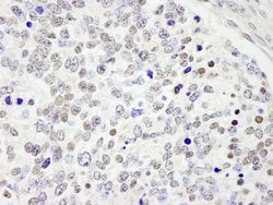 CDC25c Polyclonal Antibody, Bethyl Laboratories 100 &mu;L; Unconjugated:Antibodies,