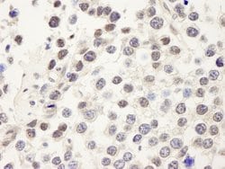 CDC25c Polyclonal Antibody, Bethyl Laboratories 100 &mu;L; Unconjugated:Antibodies,