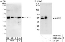 CDC37 Rabbit anti-Human, Polyclonal, Bethyl Laboratories 100 &mu;L; Unconjugated:Antibodies,