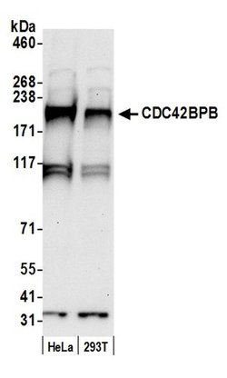 CDC42BPB/MRCK beta Rabbit anti-Human, Polyclonal, Bethyl Laboratories 100