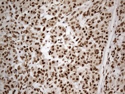 CDC45 Monoclonal Antibody (OTI4F3), TrueMAB , OriGene 100 &mu;L; Unconjugated:Antibodies,