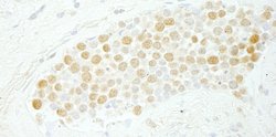 CDC5L Polyclonal Antibody, Bethyl Laboratories 10 &mu;L; Unconjugated:Antibodies,