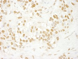 CDC5L Polyclonal Antibody, Bethyl Laboratories 10 &mu;L; Unconjugated:Antibodies,