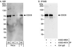 CDC6 Rabbit anti-Human, Polyclonal, Bethyl Laboratories 100 &mu;l; Unlabeled:Antibodies,