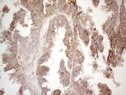 CDC6 Monoclonal Antibody (OTI1A4), TrueMAB , OriGene 100 &mu;L; Unconjugated:Antibodies,