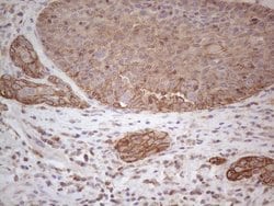 CDC6 Monoclonal Antibody (OTI1A4), TrueMAB , OriGene 100 &mu;L; Unconjugated:Antibodies,