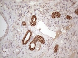 CDC6 Monoclonal Antibody (OTI1A4), TrueMAB , OriGene:Antibodies:Primary
