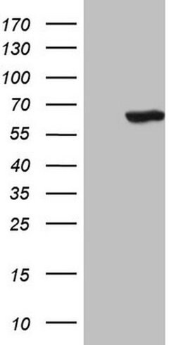 CDC6 Monoclonal Antibody (OTI7B12), TrueMAB , OriGene:Antibodies:Primary