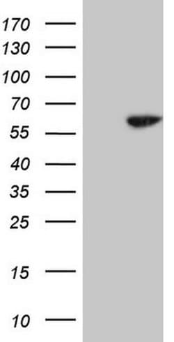 CDC6 Monoclonal Antibody (OTI1A4), TrueMAB , OriGene 100 &mu;L; Unconjugated:Antibodies,