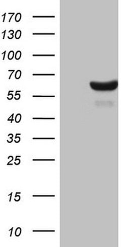 CDC6 Mouse anti-Human, Clone: OTI1B3, lyophilized, TrueMAB 100 &mu;g; Unconjugated:Antibodies,