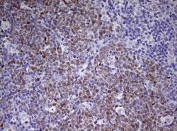 CDCA7L Mouse anti-Human, Clone: OTI6C6, lyophilized, TrueMAB 100 &mu;g;