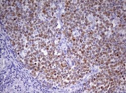 CDCA7L Mouse anti-Human, Clone: OTI6C6, lyophilized, TrueMAB 100 &mu;g;