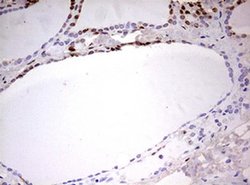 CDCA7L Monoclonal Antibody (OTI2C1), TrueMAB , OriGene 30 &mu;L; Unconjugated:Antibodies,