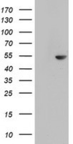 CDCA7L Mouse anti-Human, Clone: OTI6C6, lyophilized, TrueMAB 100 &mu;g;