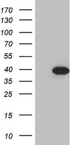 CDCA8 Mouse anti-Human, Clone: OTI2D8, lyophilized, TrueMAB 100 &mu;g;