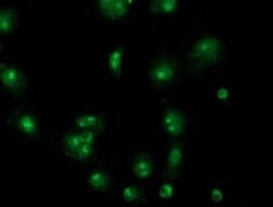 CDCP1 Monoclonal Antibody (OTI4G5), TrueMAB , OriGene 30 &mu;L; Unconjugated:Antibodies,
